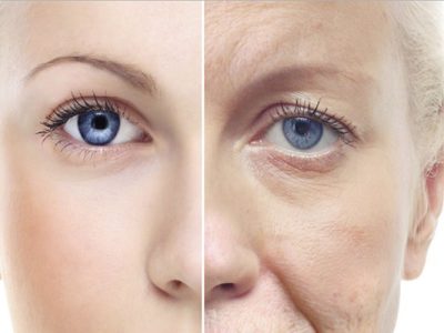 Carbon Dioxide Fractional Laser