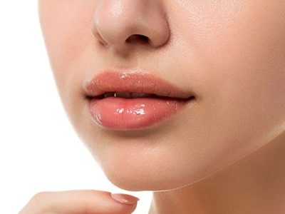 Lip Filler